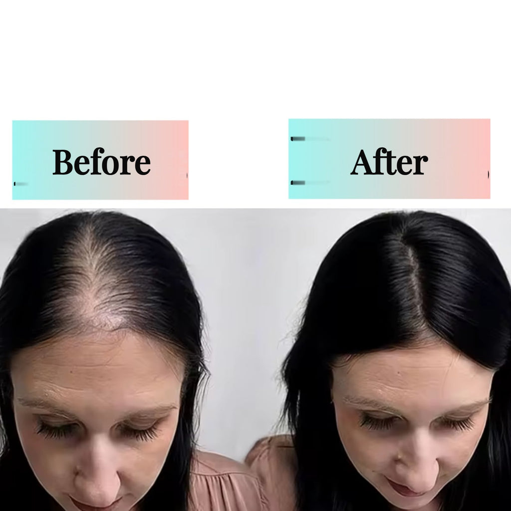 Premium Wig Topper - Natural Brazilian Hair
