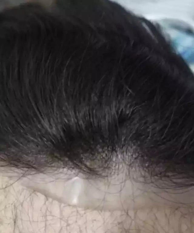 Hairline Topper - Quiff Style